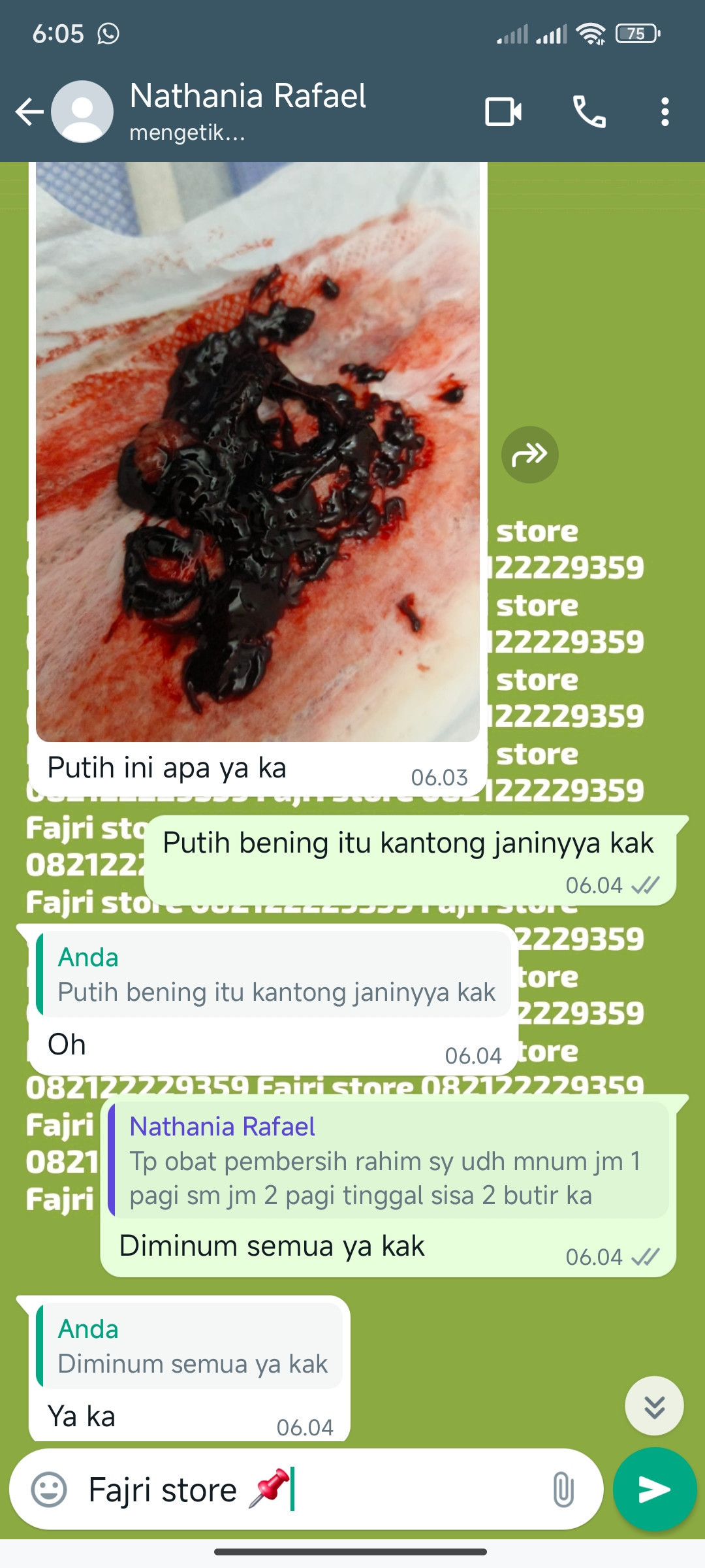 Apotik Jual Obat Aborsi 082122229359 Cytotec Cimahi COD Misoprostol