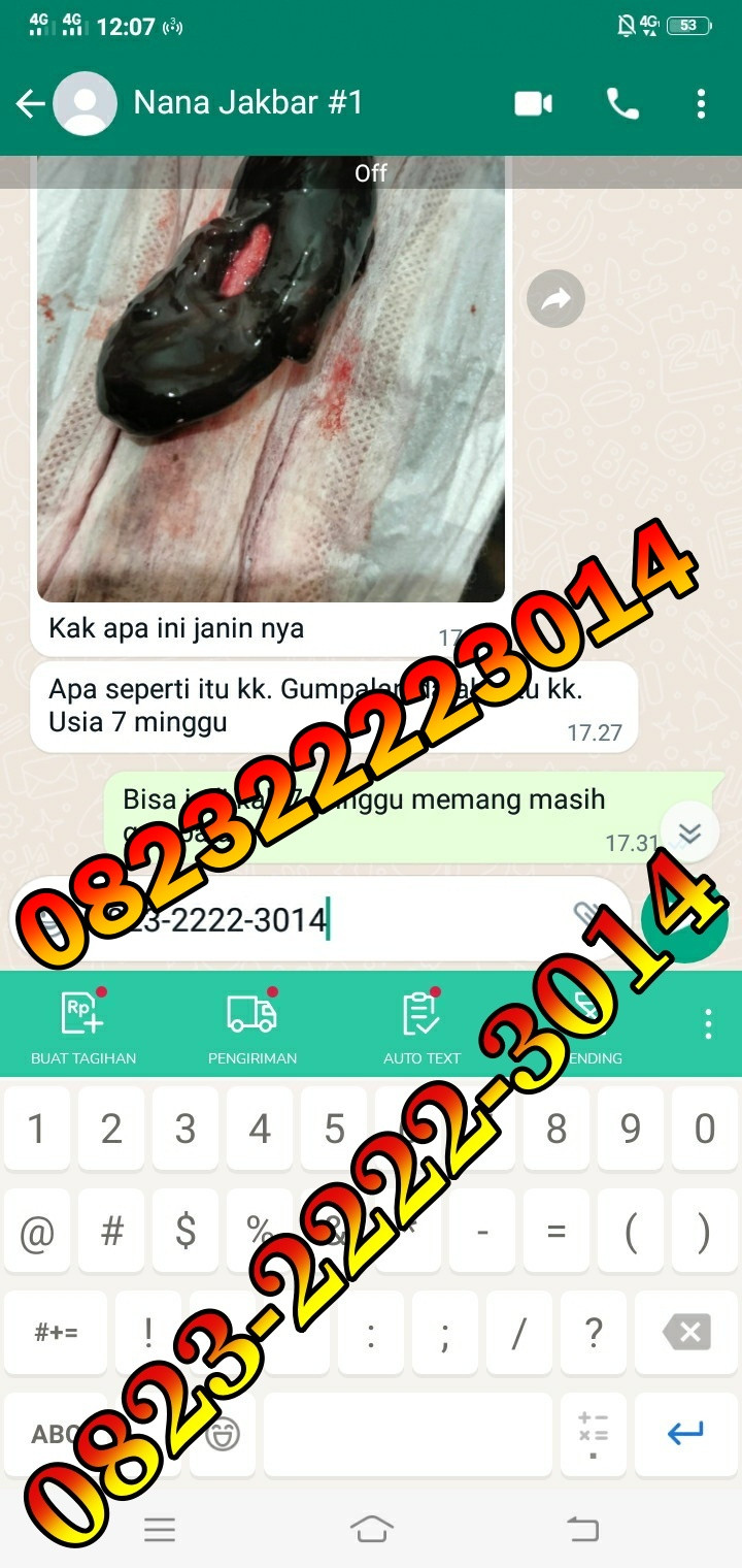 Jual Penggugur Cytotec Cianjur ^082322223014^ Jual Misoprostol Klinik Dokter Ternama